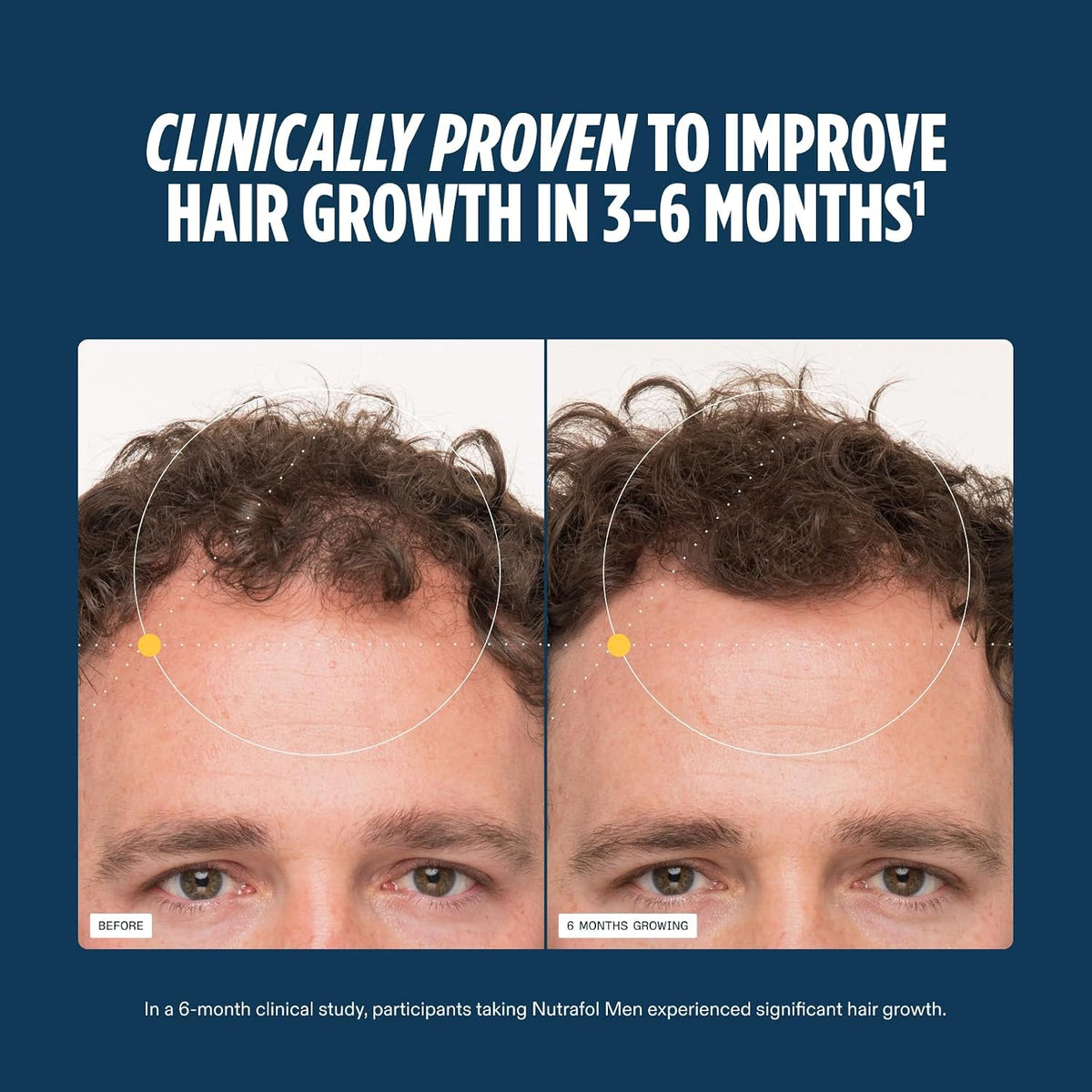 Nutrafol Men's Hair Growth Supplement – 1 Month Supply