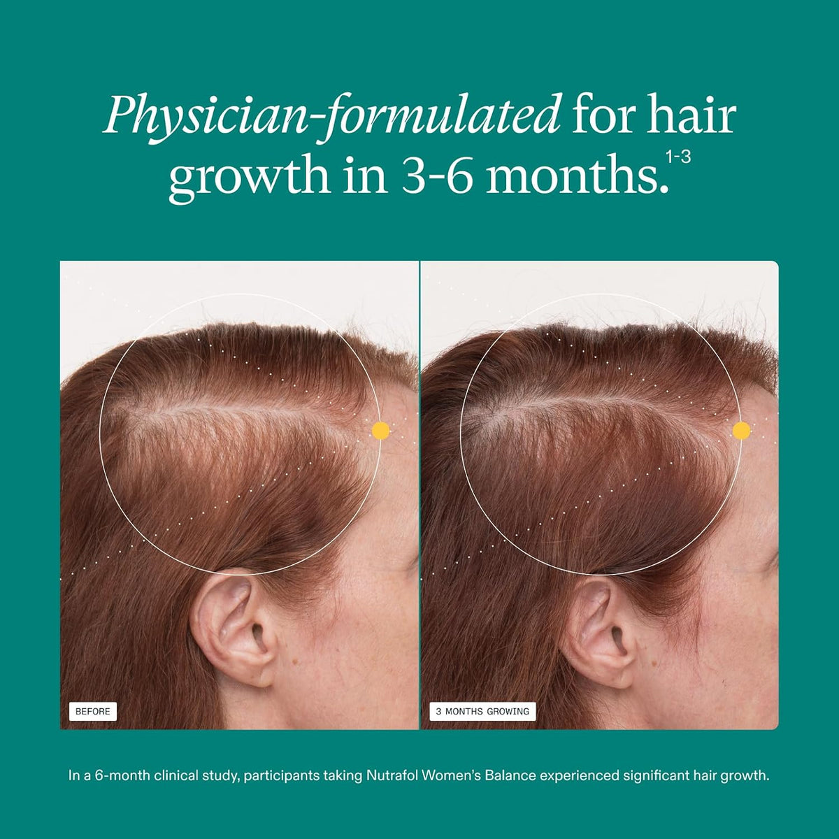 Nutrafol Women's Balance Hair Growth Supplement – Ages 45+, 1 Month Supply