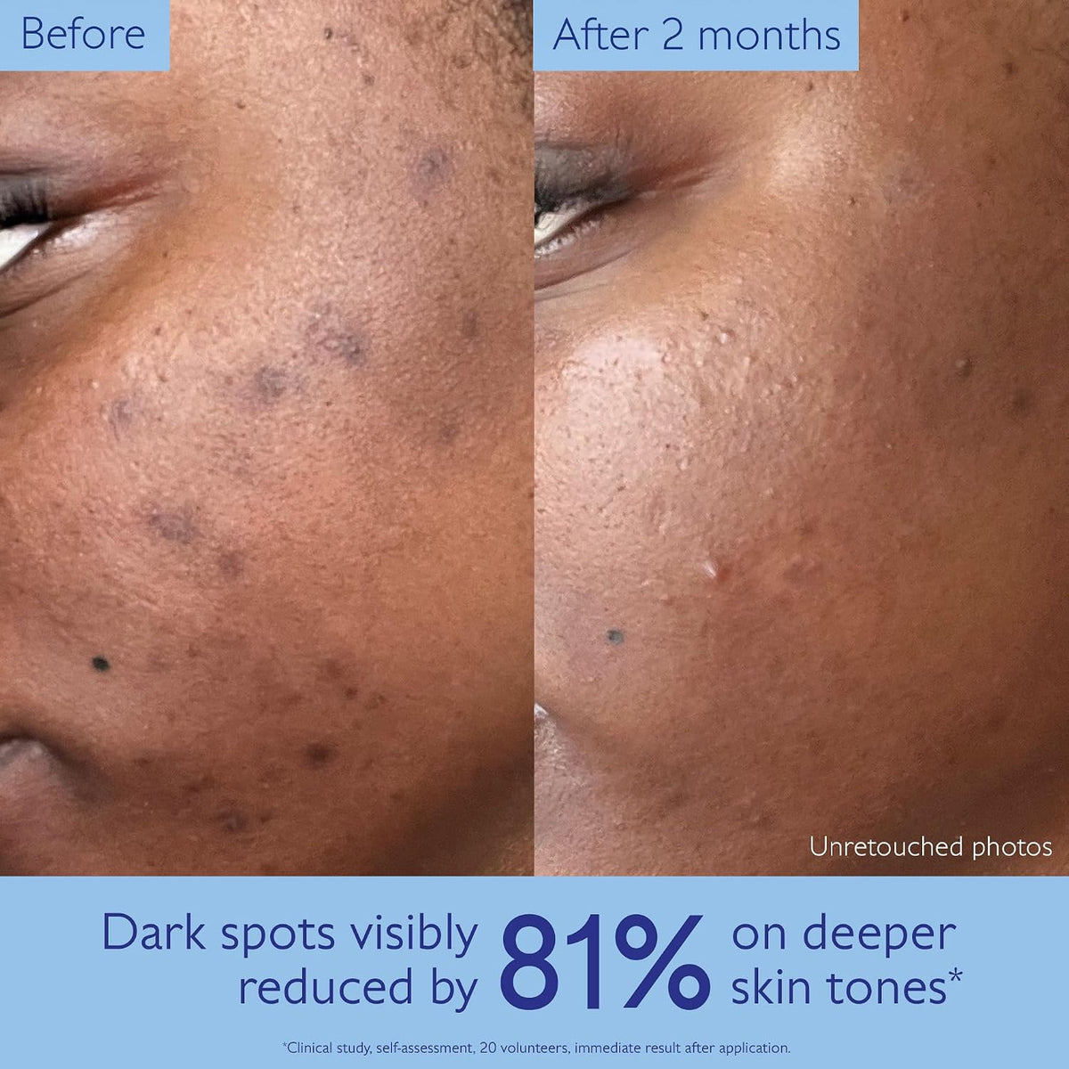 Caudalie Vinoperfect Brightening Serum – Dark Spot Corrector