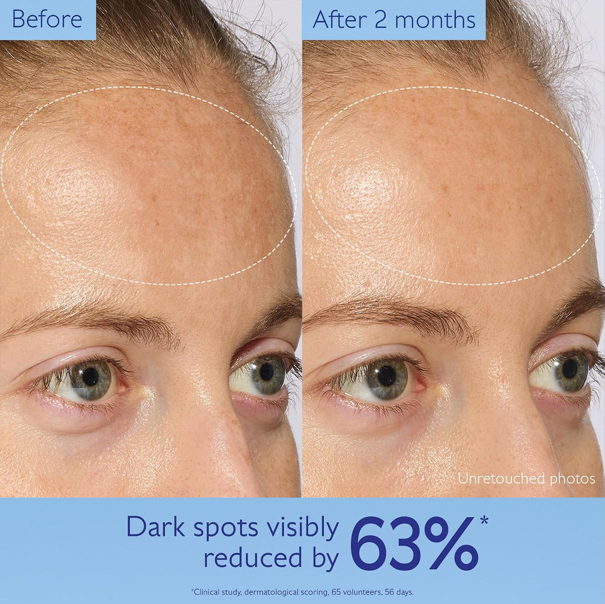 Caudalie Vinoperfect Brightening Serum – Dark Spot Corrector