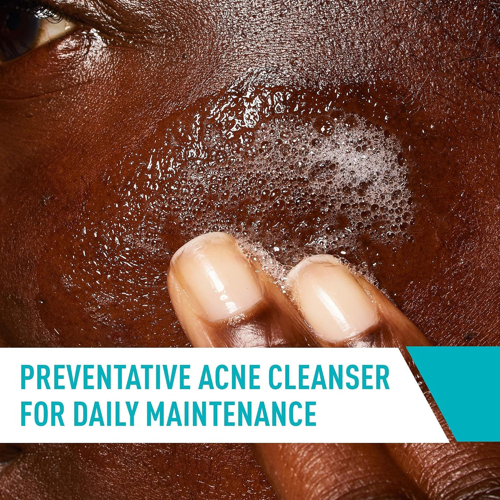 CeraVe Acne Control Face Wash, 2% Salicylic Acid, 8oz