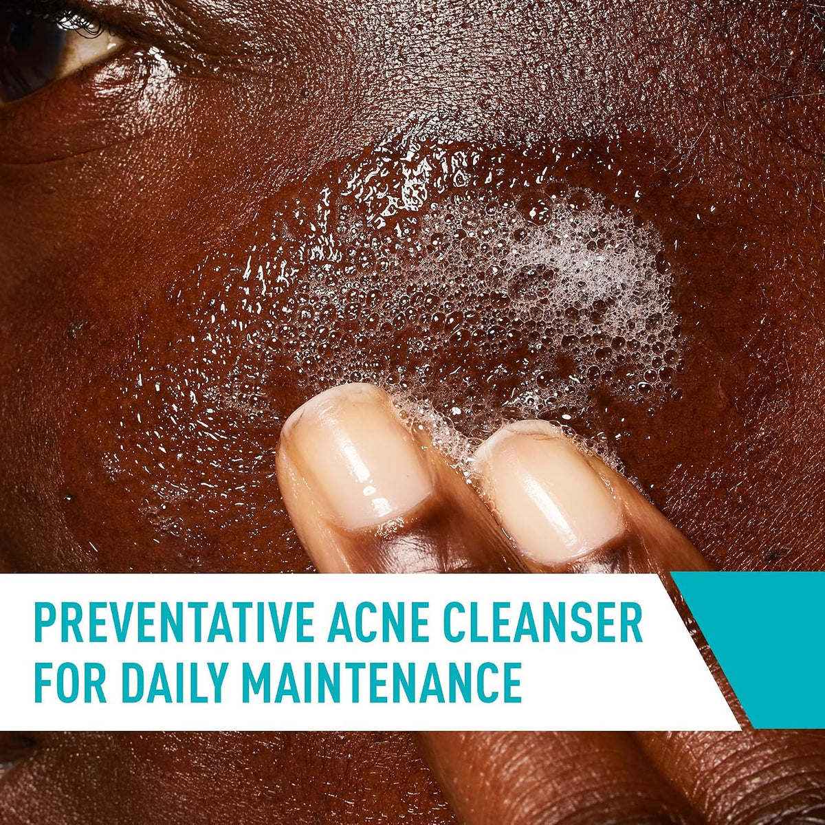 CeraVe Acne Control Face Wash, 2% Salicylic Acid, 8oz